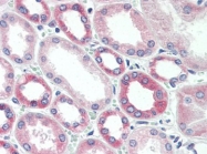 AP22680PU-N - GSK3 beta