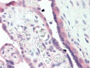 AP22680PU-N - GSK3 beta