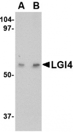 AP22675PU-N - LGI4
