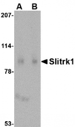 AP22669PU-N - SLITRK1
