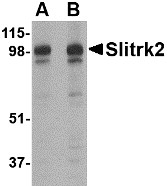 AP22670PU-N - SLITRK2