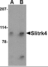 AP22671PU-N - SLITRK4