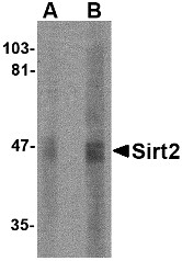 AP22674PU-N - SIRT2 / SIR2