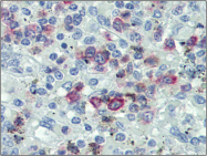 AP23148PU-N - CD178 / Fas Ligand