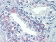 AP22688PU-N - CD178 / Fas Ligand