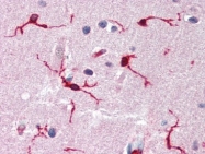 AP22691PU-N - ARHGDIB / D4-GDI