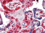 AP22691PU-N - ARHGDIB / D4-GDI