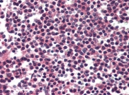 AP22694PU-N - CD178 / Fas Ligand