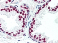 AP22695PU-N - Androgen receptor
