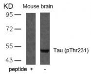 AP02402PU-S - MAPT / TAU