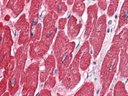 AP22707PU-N - alpha skeletal muscle Actin / ACTA1