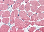 AP22707PU-N - alpha skeletal muscle Actin / ACTA1