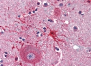 AP22708PU-N - APAF1