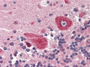 AP22710PU-N - Guanylate cyclase soluble GUCY1B3