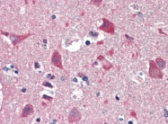 AP22710PU-N - Guanylate cyclase soluble GUCY1B3