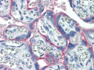 AP22713PU-N - HGF receptor