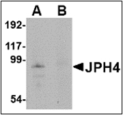 AP23123PU-N - Junctophilin-4 / JPH4