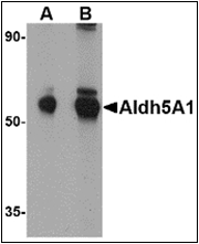 AP23122PU-N - ALDH5A1 / SSADH
