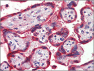 AP23121PU-N - Thrombospondin-1 (THBS1)