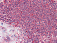 AP23121PU-N - Thrombospondin-1 (THBS1)