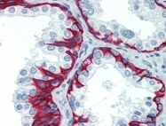 AP22726PU-N - Cytokeratin 5