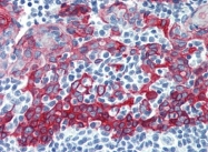 AP22726PU-N - Cytokeratin 5