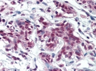 AP22727PU-N - CREB-binding protein
