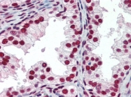 AP22727PU-N - CREB-binding protein