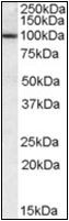 AP23101PU-N - CLCA1