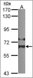 AP23098PU-N - HDAC1