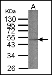 AP23097PU-N - ACADS