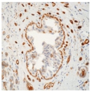 AM00208AF-N - Transglutaminase-2 (TGM2)