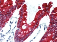 AP22738PU-N - Cytokeratin 20