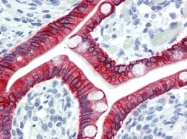 AP22738PU-N - Cytokeratin 20