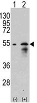 AP22746PU-N - SLC29A1 / ENT1