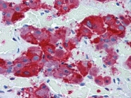 AP22754PU-N - Synaptophysin / SYP