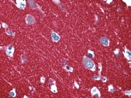 AP22754PU-N - Synaptophysin / SYP