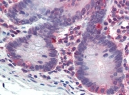 AP22755PU-N - Caspase-1
