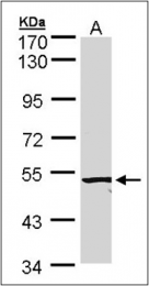 AP23077PU-N - ACVRL1 / ALK1