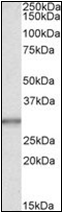 AP23069PU-N - Carbonic anhydrase 1