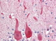 AP22780PU-N - Aldolase C / ALDOC