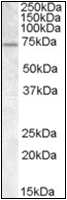 AP23068PU-N - FMR1 / FMRP
