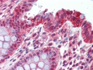 AP22798PU-N - CD49f / ITGA6
