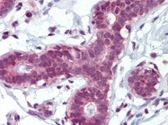 AP22804PU-N - Alpha-enolase / ENO1
