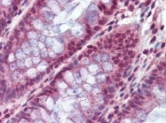 AP22804PU-N - Alpha-enolase / ENO1