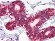 AP22805PU-N - Alpha-enolase / ENO1