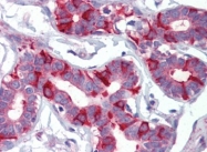 AP22808PU-N - Fatty acid synthase
