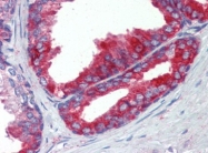 AP22808PU-N - Fatty acid synthase