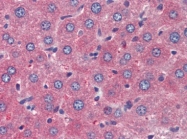 AP22809PU-N - TSLP