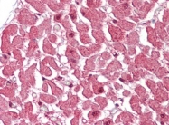AP22812PU-N - Caspase-12